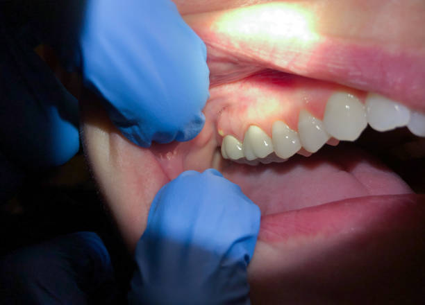 Best Knocked-Out Tooth Emergency  in North Mankato, MN