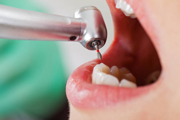 Best Emergency Tooth Extraction  in North Mankato, MN